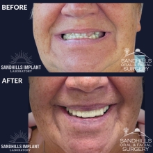 Before & After