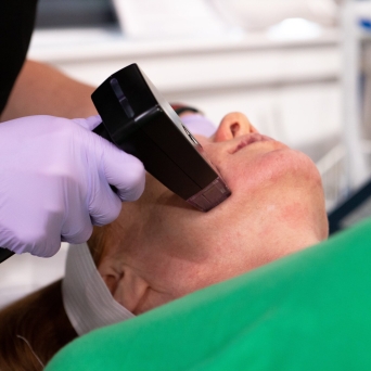 Microneedling Treatment